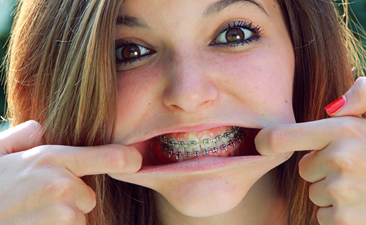Caring for Braces